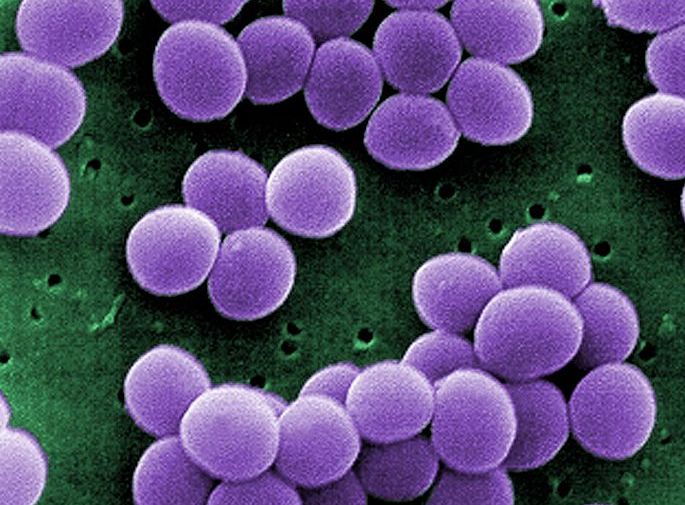 Staphylococcus-aureus